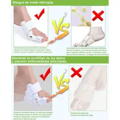 KIDSHOP - Corrector de Juanetes X2 Unidades
