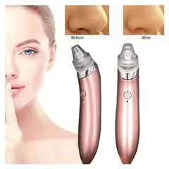 GENERICO - Extractor removedor de espinillas profesional