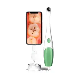 OEM - Endoscopio dental para celulares android tablets pc