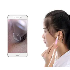 OEM - Otoscopio para celulares android computadores