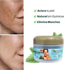 IMAGENCIT - Mascarilla Aclarante Elimina Manchas