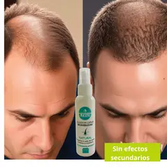 GENERICO - Solución Capilar Regeneradora Maseri