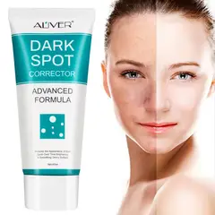 GENERICO - Crema Desmanchadora Rostro - Crema Desvanecedora De Manchas