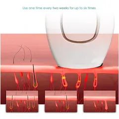 GENERICO - DEPILADORA LASER IPI PERMANENTE