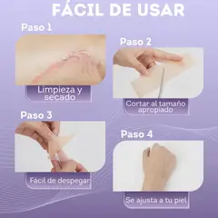 GENERICO - Cinta de Silicona de 3 metros para Cicatrices