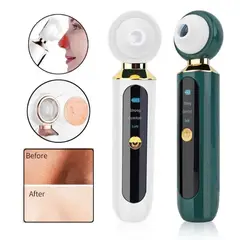GENERICO - Extractor de espinillas y puntos negros recargable con lupa led
