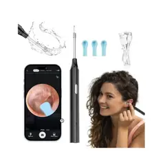 GENERICO - Limpiador De Oídos Inteligente Con Cámara HD Y WiFi