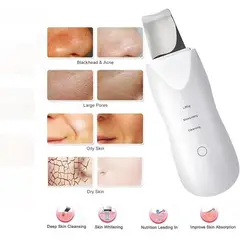 GENERICO - Peeling facial antiarrugas ultrasónico para acné y puntos negros